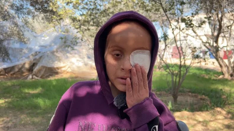 Malak al-Najjar, aged 13, lost an eye on the same night of the Israeli military raid